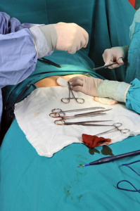 Open Discectomy