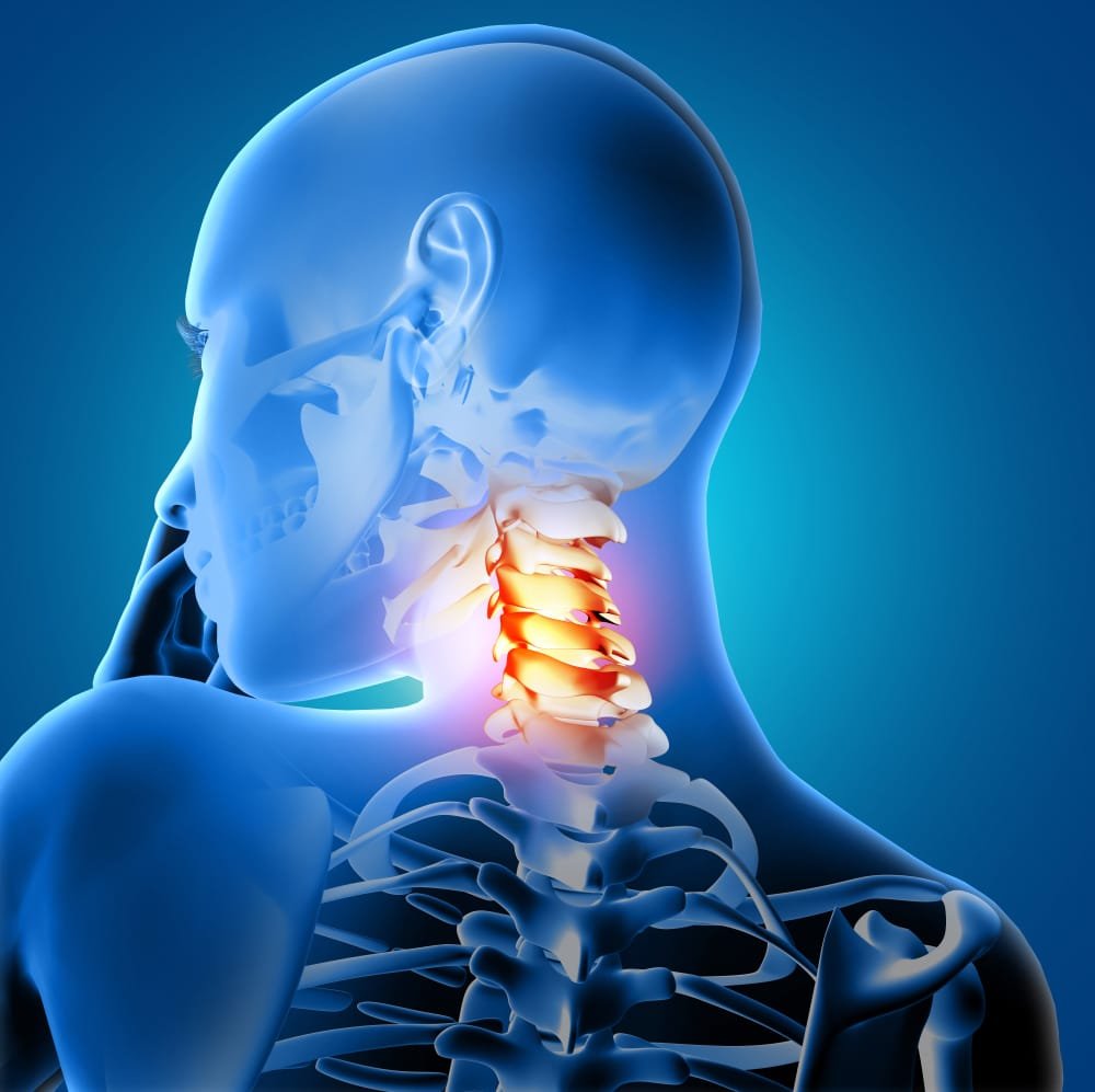 Back Pain