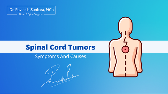 What Are Spinal Cord Tumors Symptoms And Causes