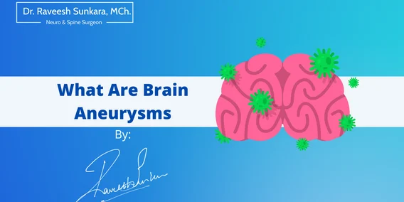What Are Brain Aneurysms What Are Brain Aneurysms