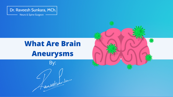 What Are Brain Aneurysms What Are Brain Aneurysms