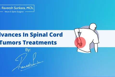 Advances In Spinal Tumour Treatments Advances In Spinal Tumour Treatments