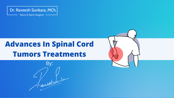 Advances In Spinal Cord Tumor Treatments Dr Raveesh Sunkara 0703