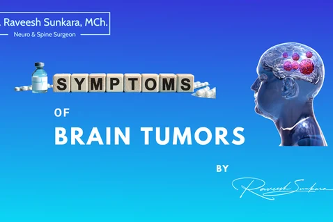 Knowing the Symptoms: How to Recognize a Brain Tumour Early On