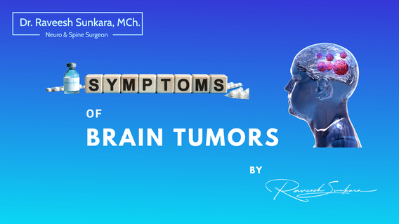 Know the Symptoms: How to Recognize a Brain Tumour Early On Knowing the Symptoms: How to Recognize a Brain Tumour Early On
