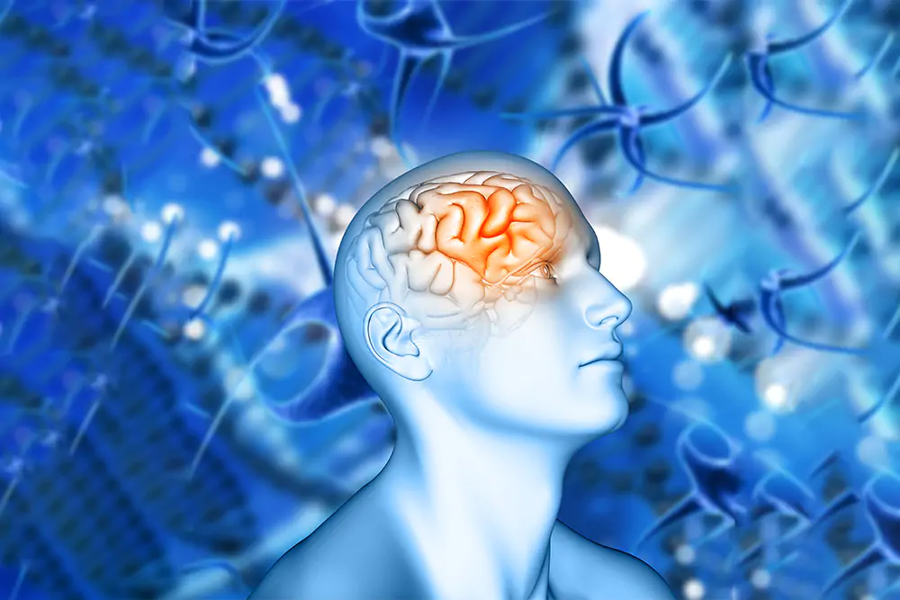 Brain_Aneurysm_1 Brain_Aneurysm