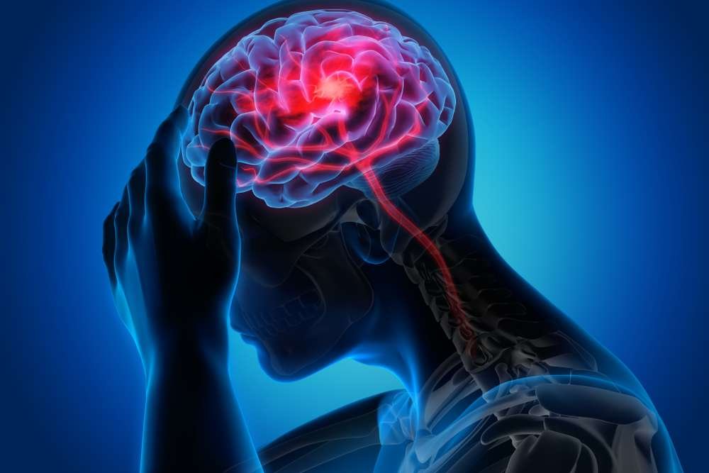 Brain_Stroke.jpeg Brain_Stroke.jpeg