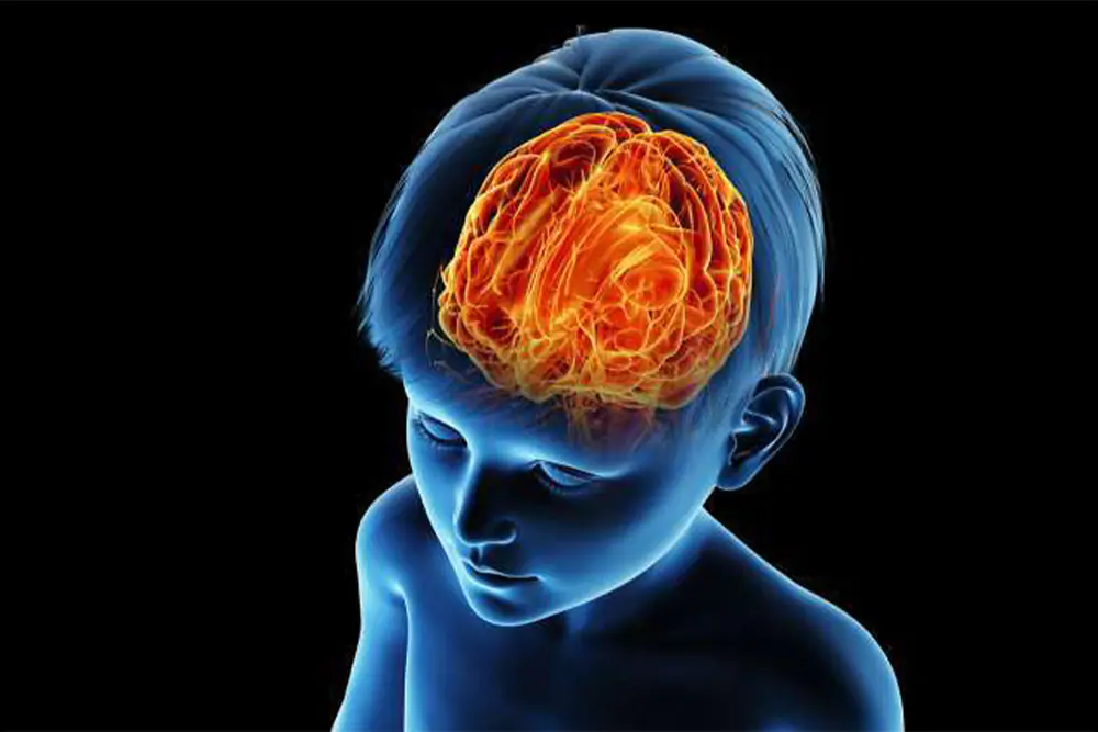 Pediatric-Neurosurgery_1 Pediatric-Neurosurgery