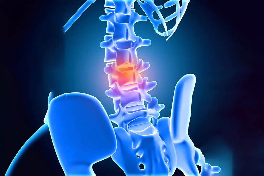 Slip_Disc_Treatment_1 Slip_Disc_Treatment