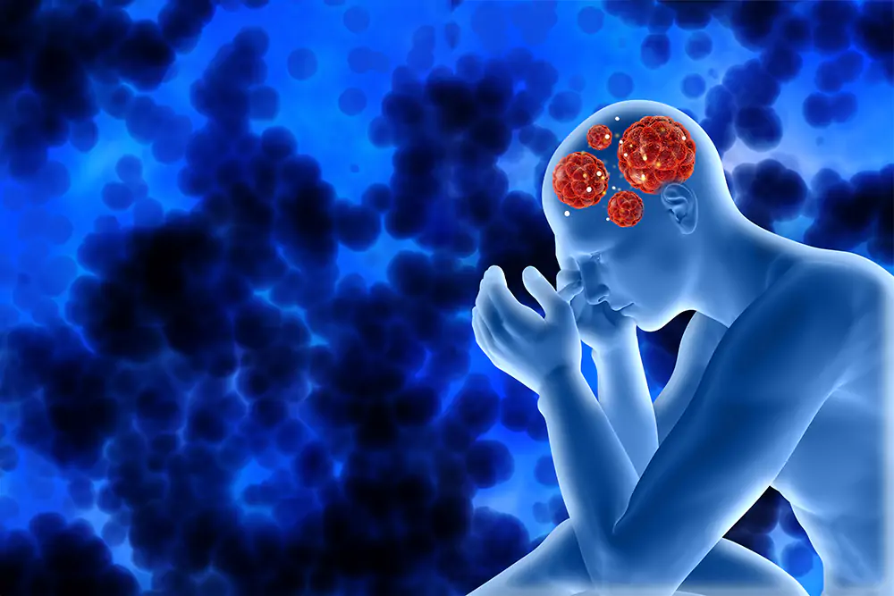 Subdural_Hematoma_1 Subdural_Hematoma