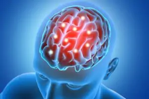 brain-stroke