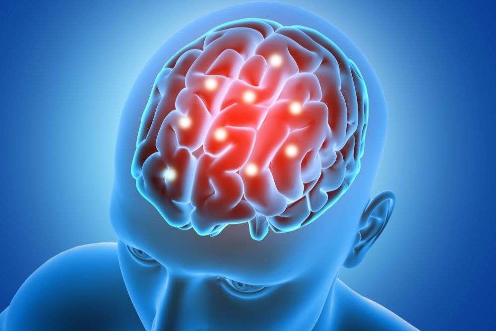 brain-stroke brain-stroke