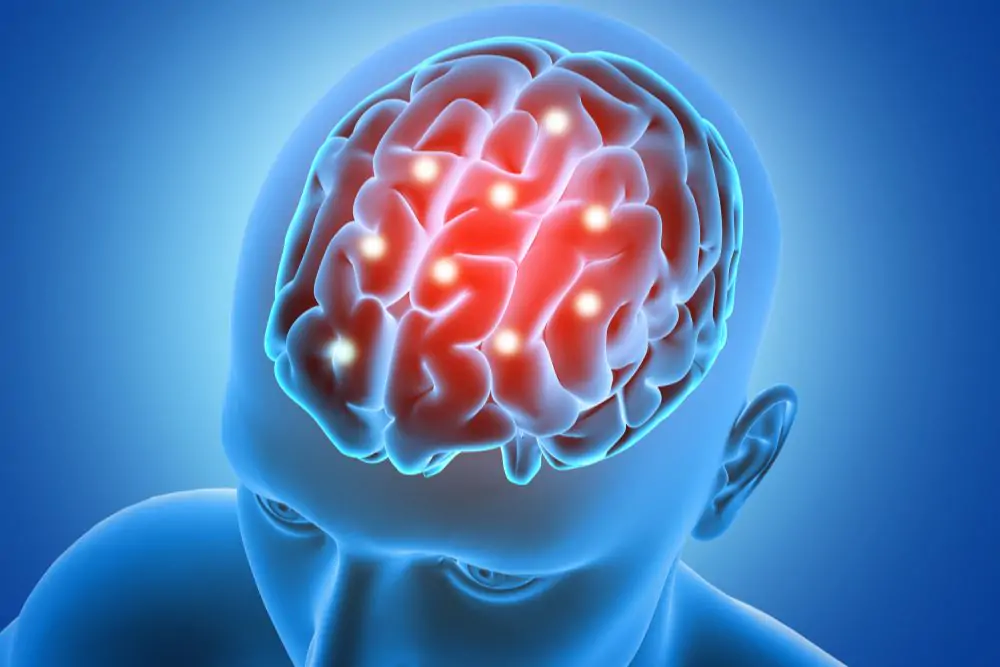 brain-stroke brain-stroke