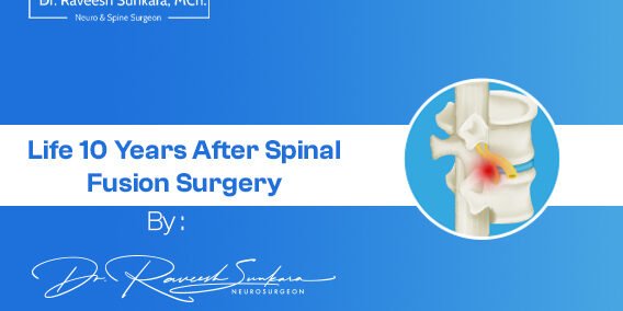 10years after spinal fusion surgery blog banner