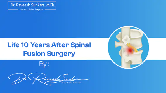 10years after spinal fusion surgery blog banner