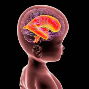Pediatric Hydrocephalus