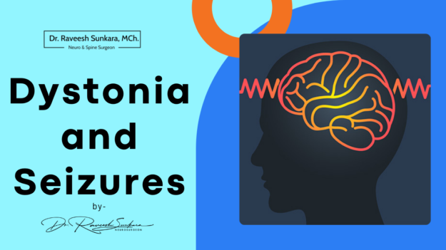 Dystonia and Seizures