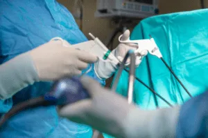 Minimally Invasive Discectomy (MID)