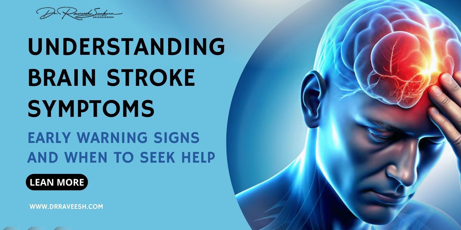 Brain Stroke Symptoms