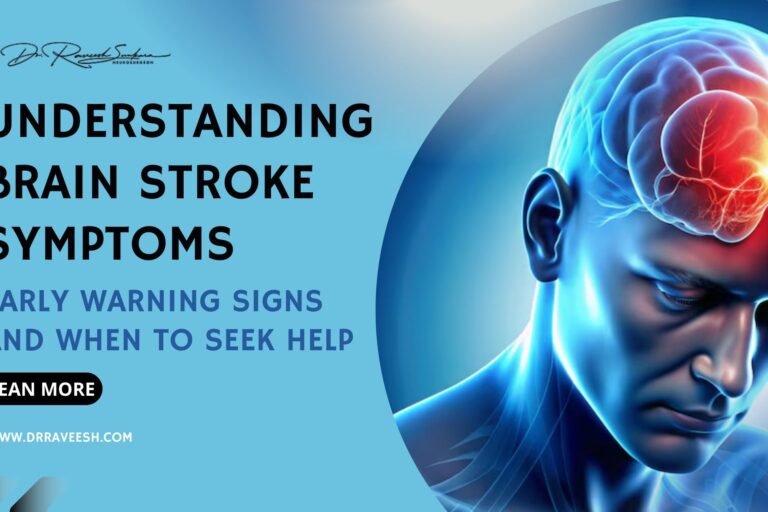 Brain Stroke Brain Stroke Symptoms