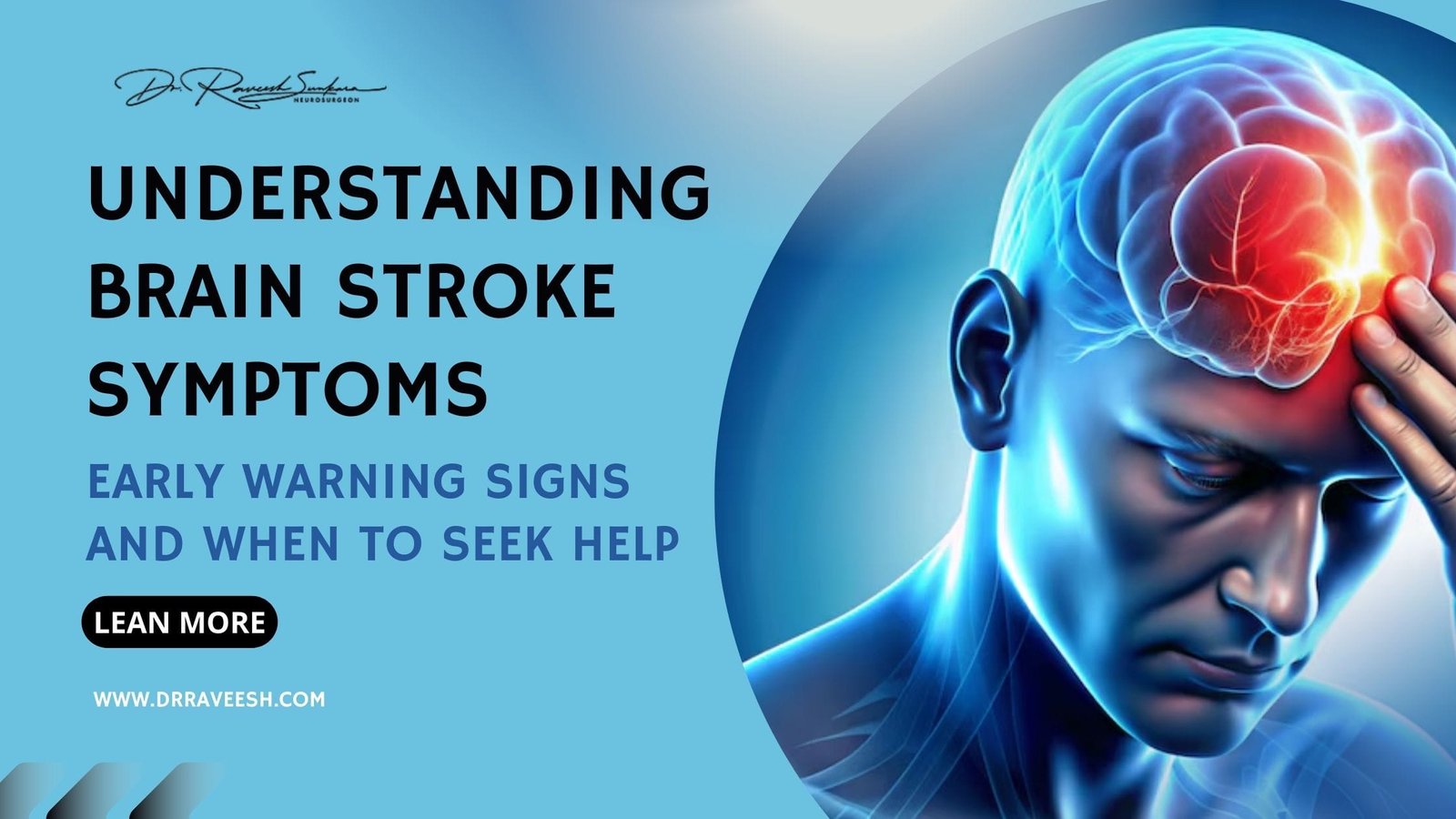 Brain Stroke Brain Stroke Symptoms