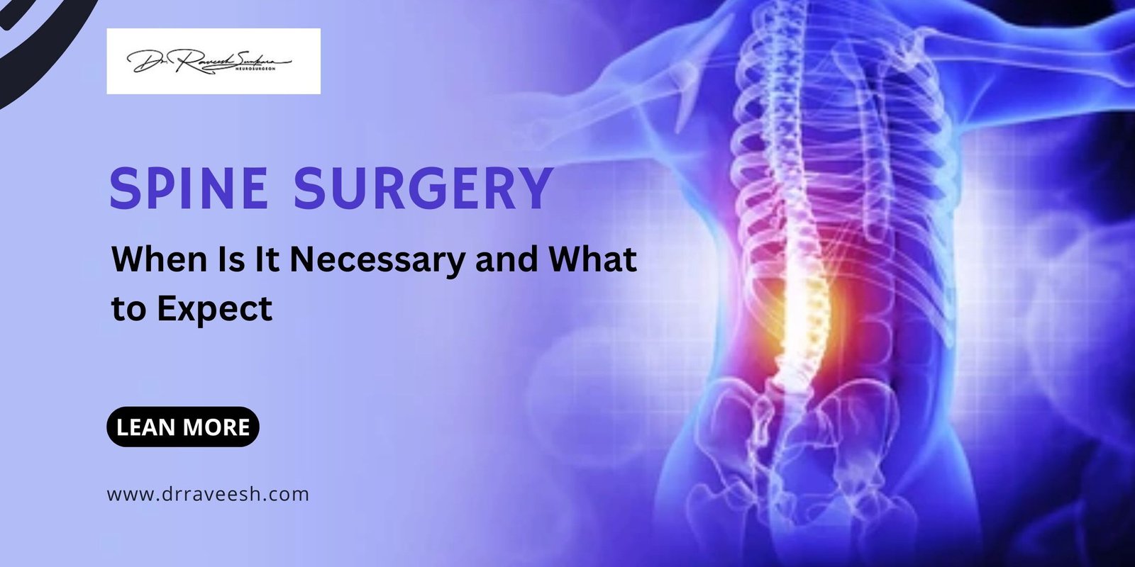 best spine surgeon in Hyderabad