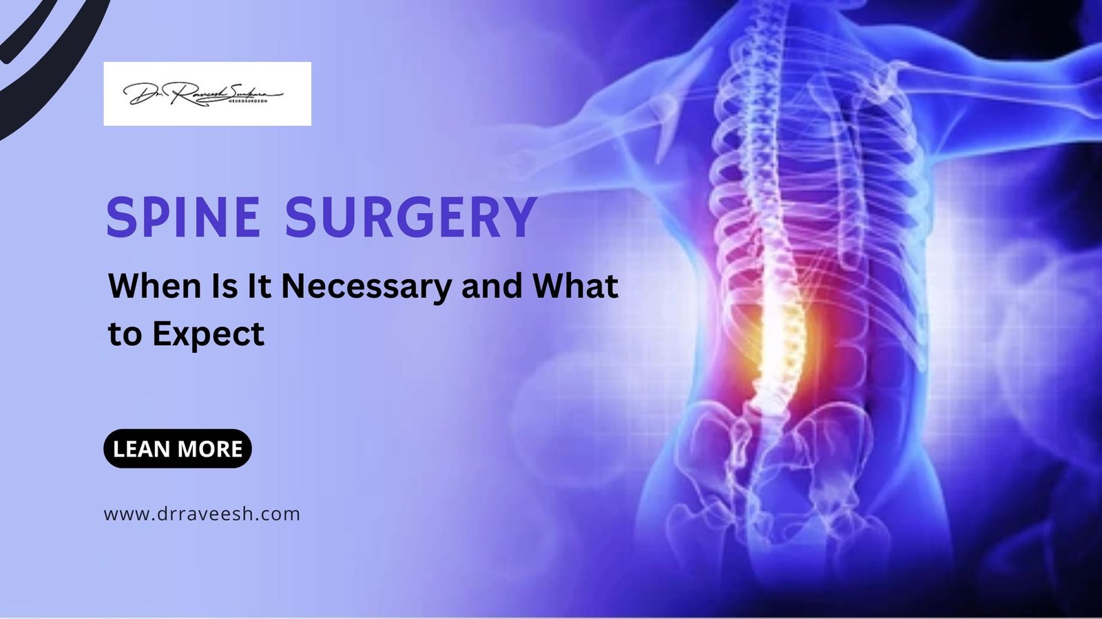 Spine Surgery best spine surgeon in Hyderabad