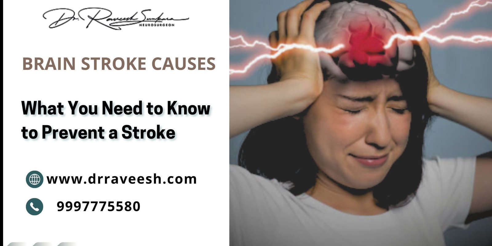 Brain Stroke Causes