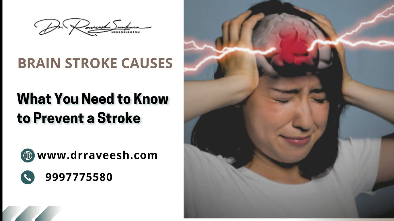 Brain Stroke Causes Brain Stroke Causes