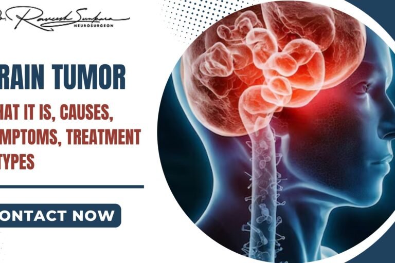 Brain Tumors Brain Tumors