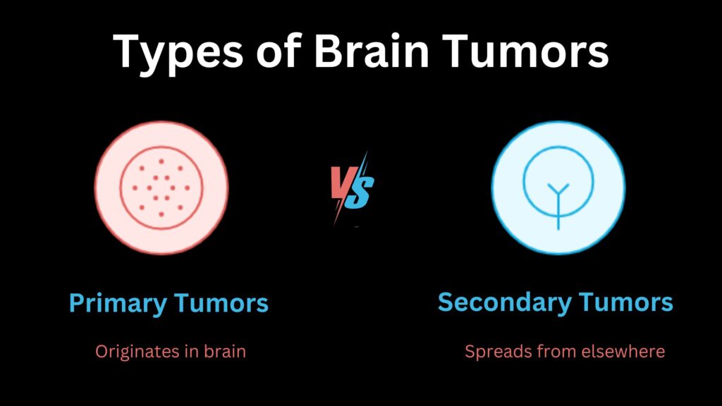 Types of Brain Tumors