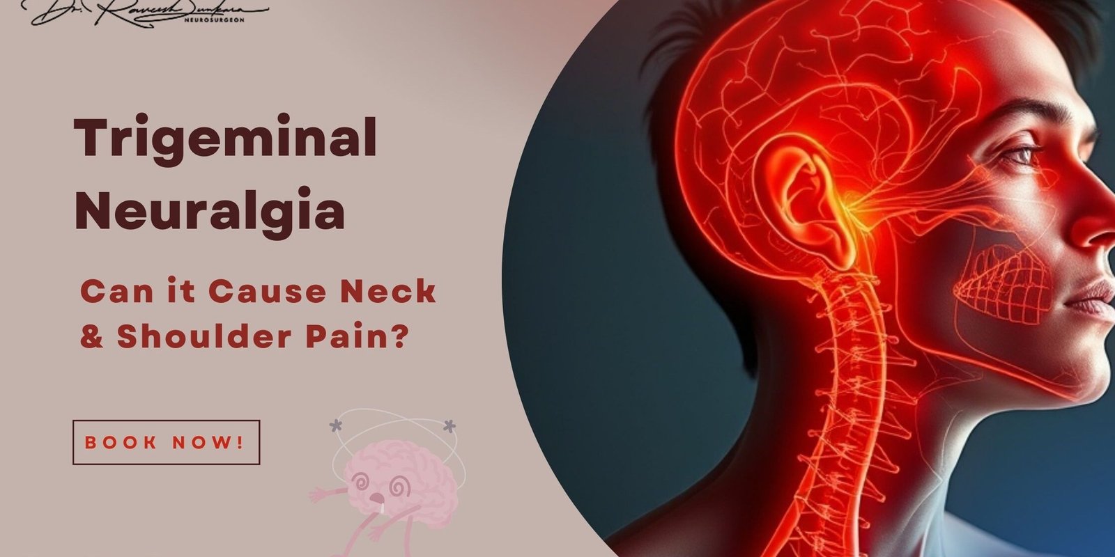 trigeminal neuralgia natural treatment