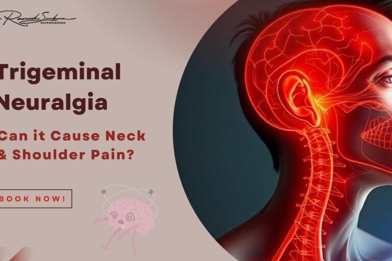 trigeminal neuralgia natural treatment trigeminal neuralgia natural treatment