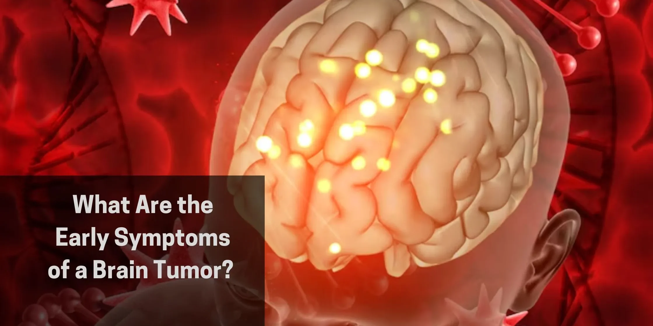 Symptoms of a Brain Tumor (1)
