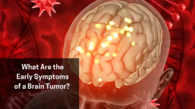 Symptoms of a Brain Tumor (1)