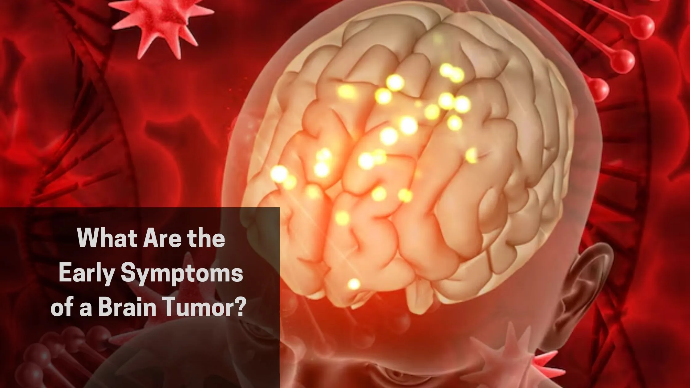 Symptoms of a Brain Tumor (1)