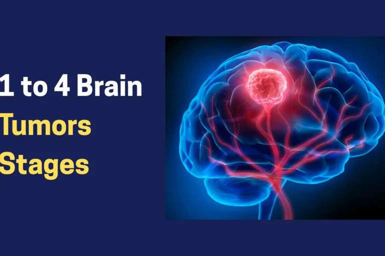 1 to 4 Brain Tumors Stages (1) Stage 1 to Stage 4 Brain Tumors