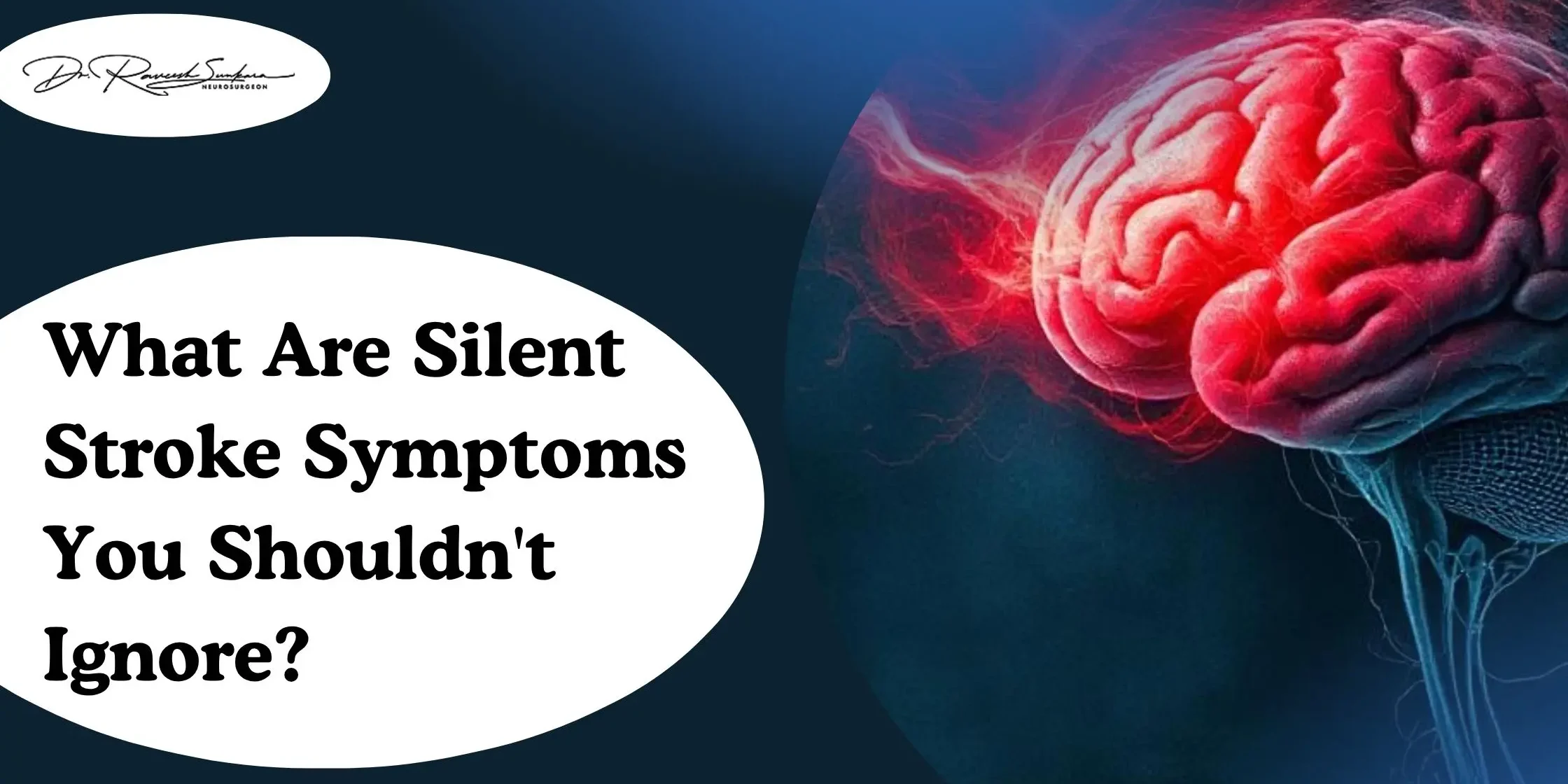 What Are Silent Stroke Symptoms You Shouldn’t Ignore Silent Brain Stroke Symptoms