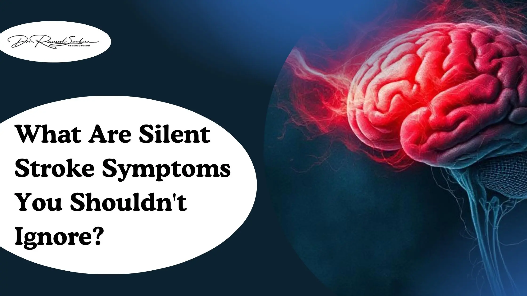 What Are Silent Stroke Symptoms You Shouldn’t Ignore Silent Brain Stroke Symptoms
