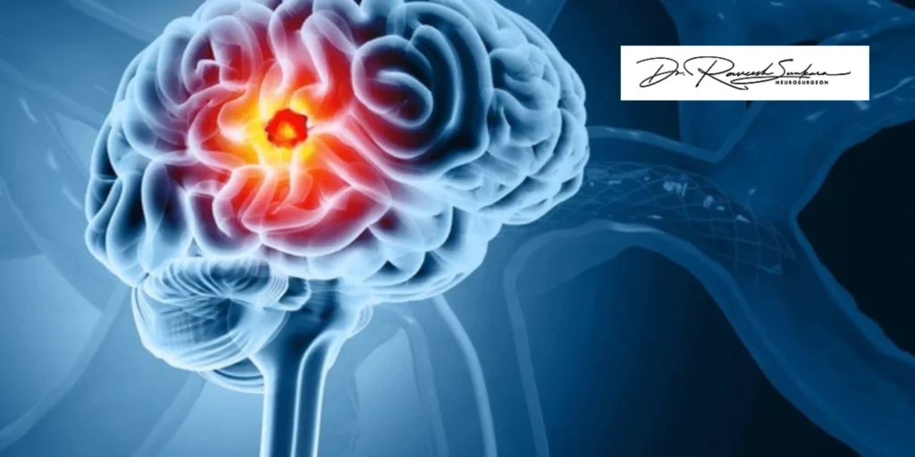 brain tumor surgery in India