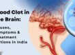 Blood Clot in the Brain