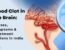 Blood Clot in the Brain