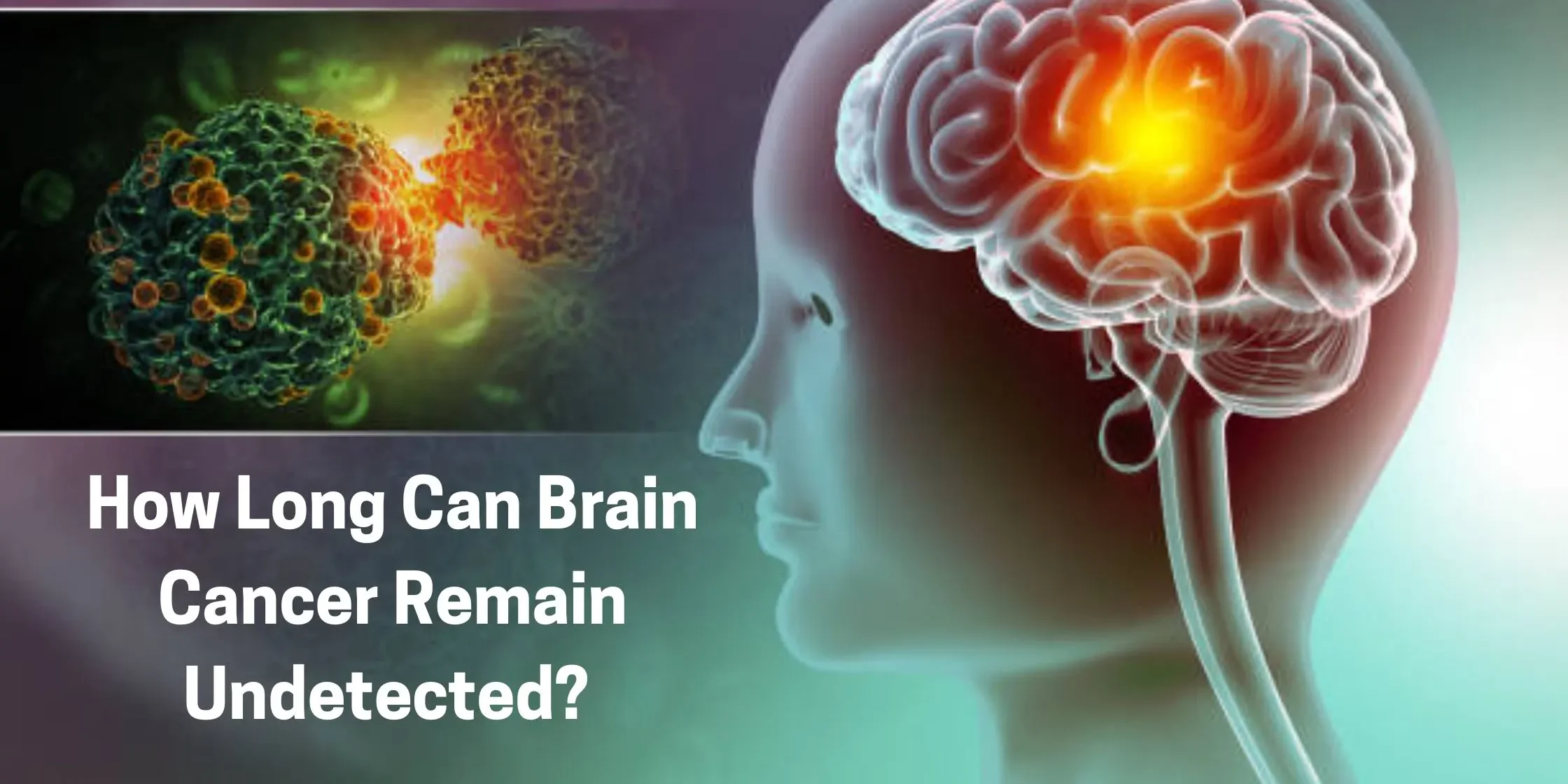 Brain Cancer Brain Cancer