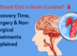 blood clot in brain treatment