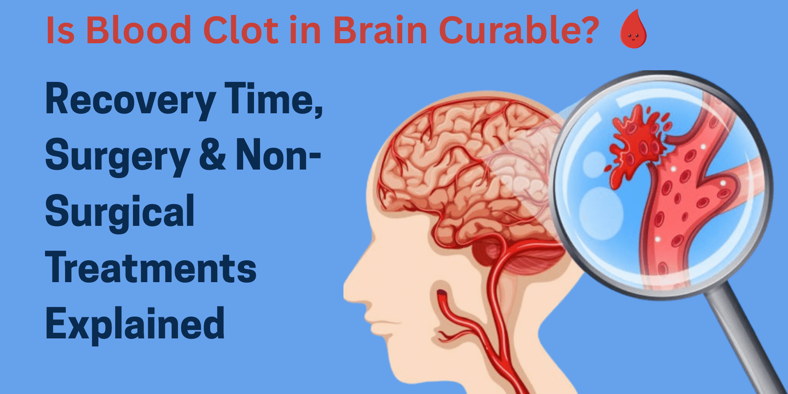 blood clot in brain treatment blood clot in brain treatment