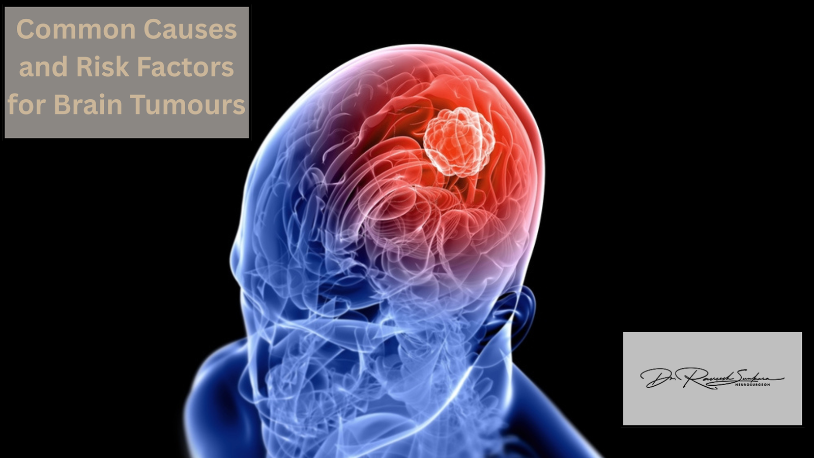 Common Causes and Risk Factors for Brain Tumours