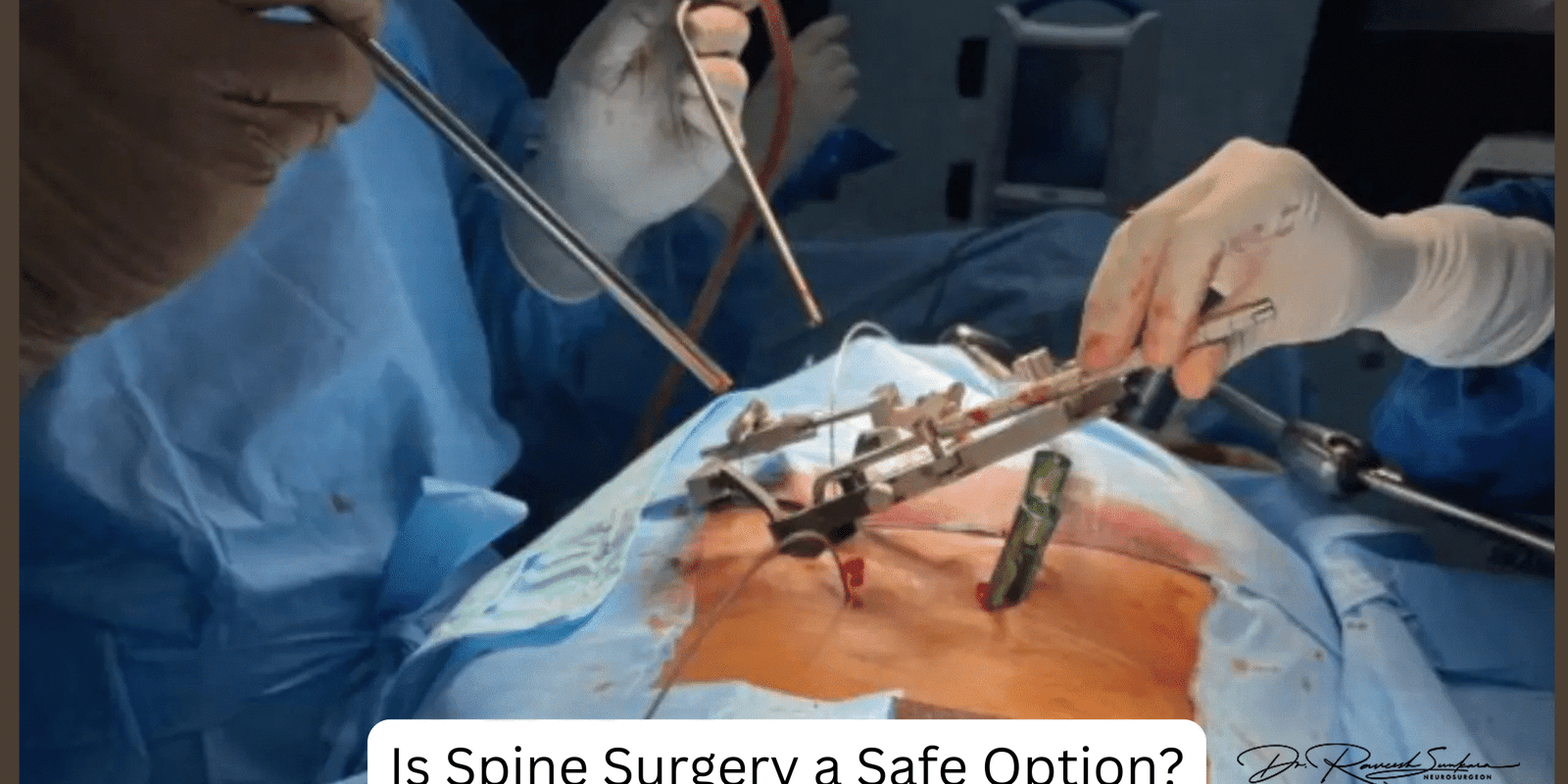 Is Spine Surgery a Safe Option Is Spine Surgery a Safe Option